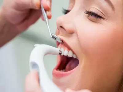 Profilaxis dental