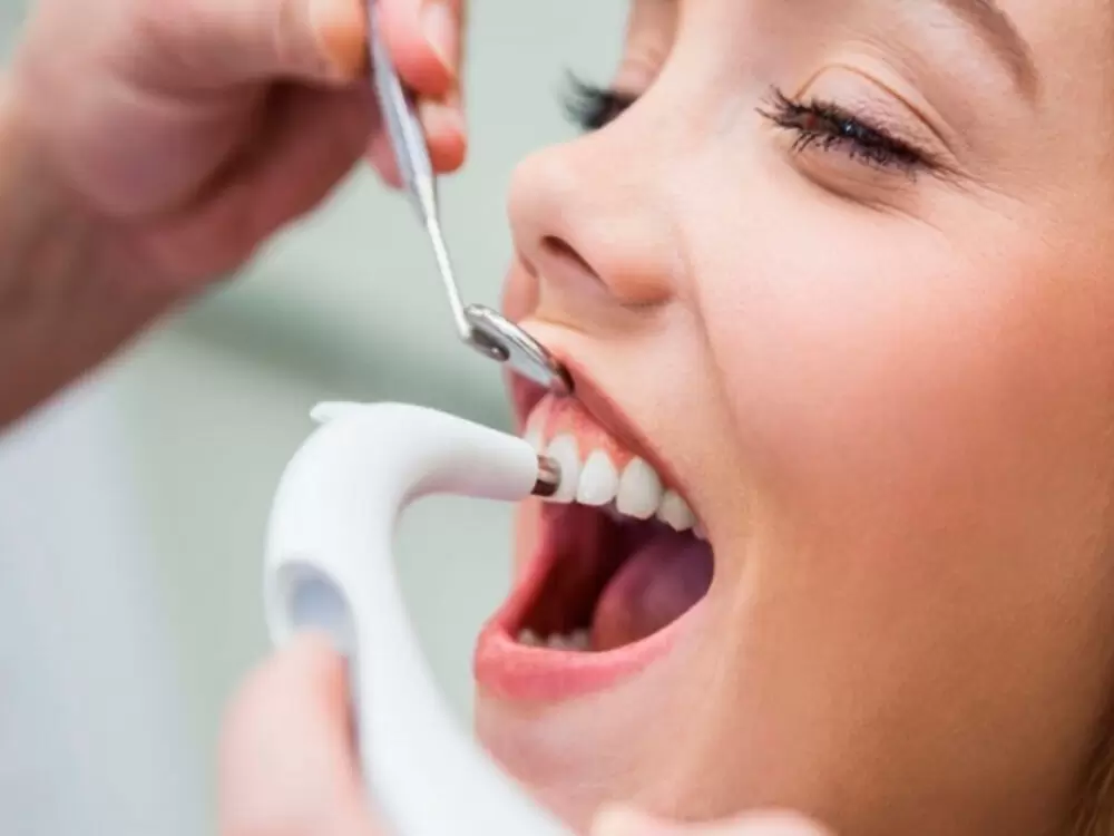 Profilaxis dental